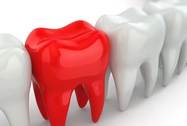 What’s a Dental Emergency?