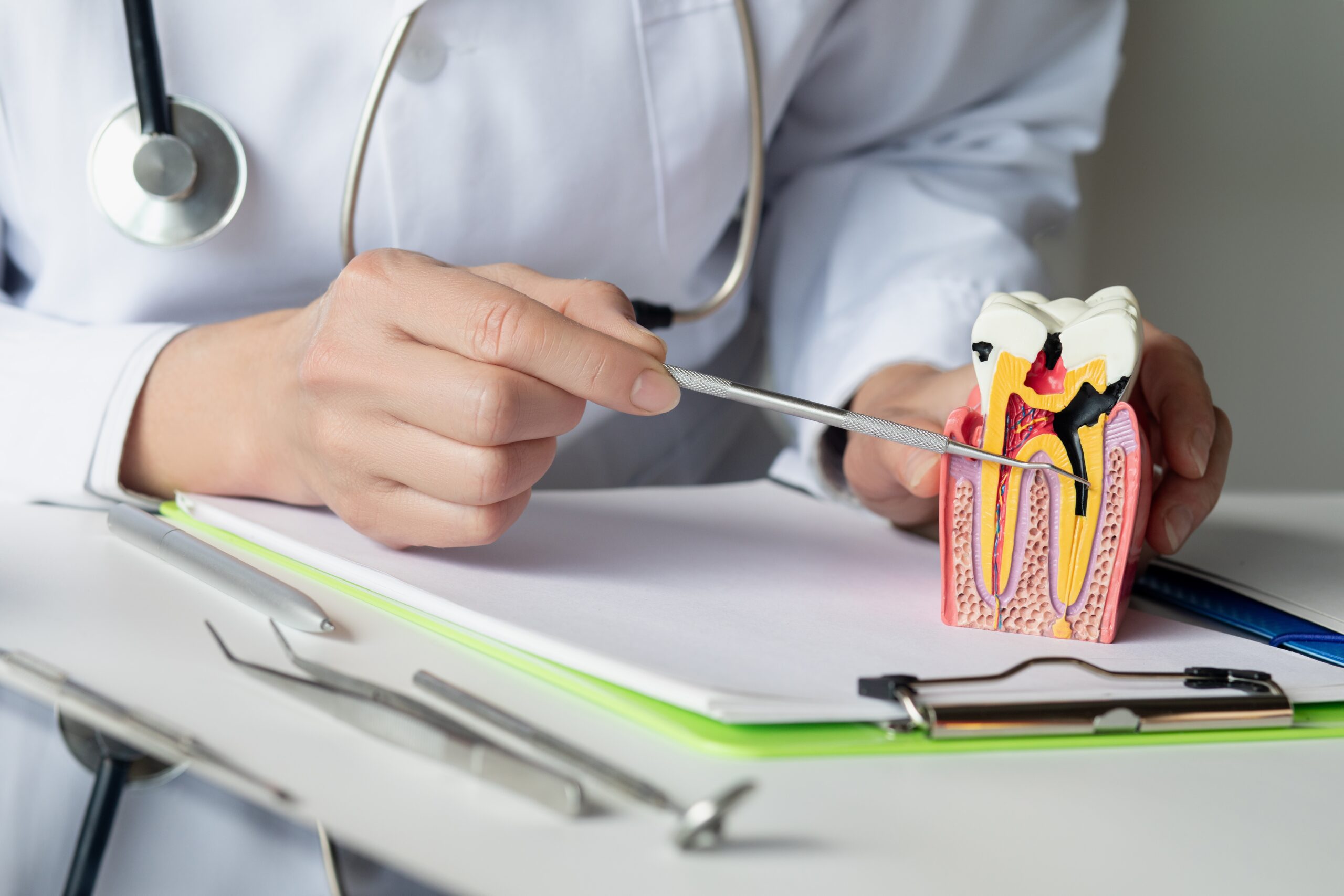 What Exactly Happens During a Root Canal?