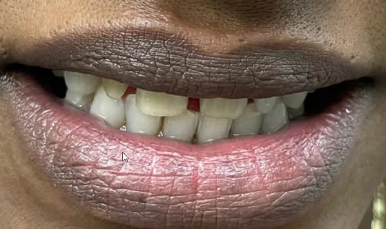 3smilebefore