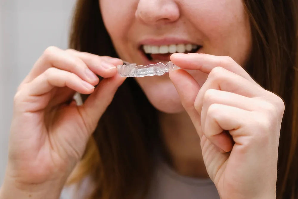A woman fitting a clear aligner over her teeth
